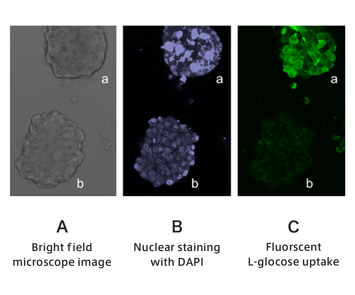 Experiment of selective incorporation into cancer cells